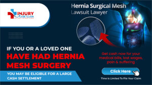 Hernia Mesh